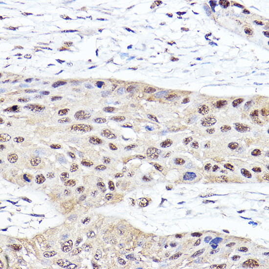 PSMB2 Antibody in Immunohistochemistry (Paraffin) (IHC (P))