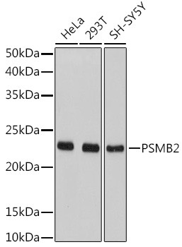 PSMB2 Antibody in Western Blot (WB)