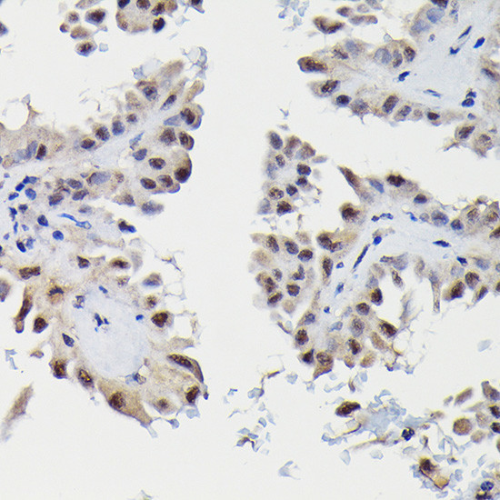 SNRPE Antibody in Immunohistochemistry (Paraffin) (IHC (P))