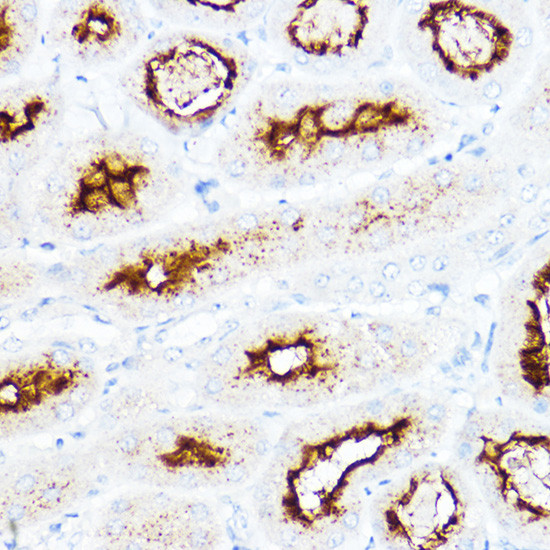 SLC3A1 Antibody in Immunohistochemistry (Paraffin) (IHC (P))