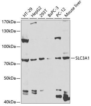 SLC3A1 Antibody in Western Blot (WB)