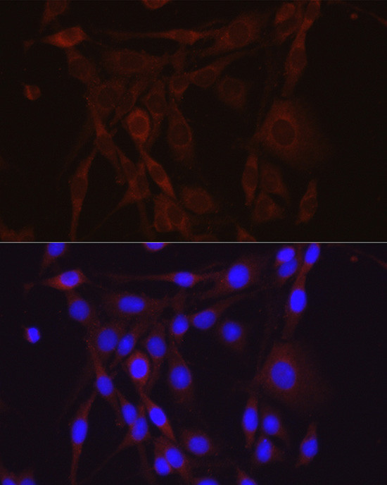 alpha-ENaC Antibody in Immunocytochemistry (ICC/IF)