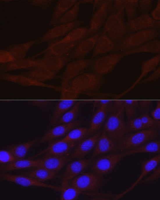 alpha-ENaC Antibody in Immunocytochemistry (ICC/IF)