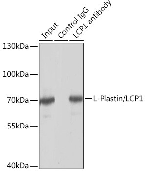 L-Plastin Antibody in Immunoprecipitation (IP)