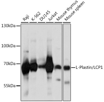 L-Plastin Antibody in Western Blot (WB)