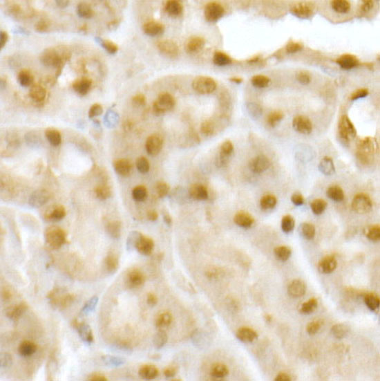 RNF2 Antibody in Immunohistochemistry (Paraffin) (IHC (P))