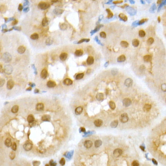 RNF2 Antibody in Immunohistochemistry (Paraffin) (IHC (P))