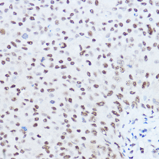 SKIV2L2 Antibody in Immunohistochemistry (Paraffin) (IHC (P))