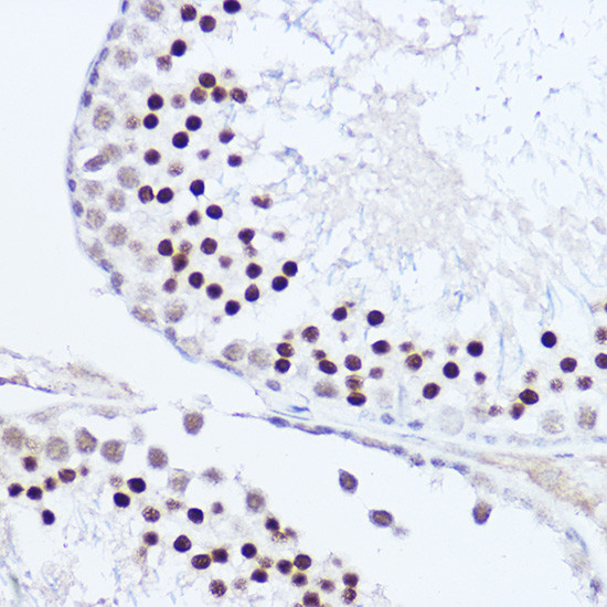 SKIV2L2 Antibody in Immunohistochemistry (Paraffin) (IHC (P))