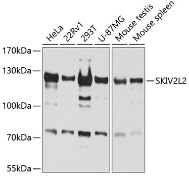 SKIV2L2 Antibody in Western Blot (WB)