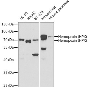 Hemopexin Antibody in Western Blot (WB)