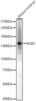 ROR2 Antibody in Western Blot (WB)