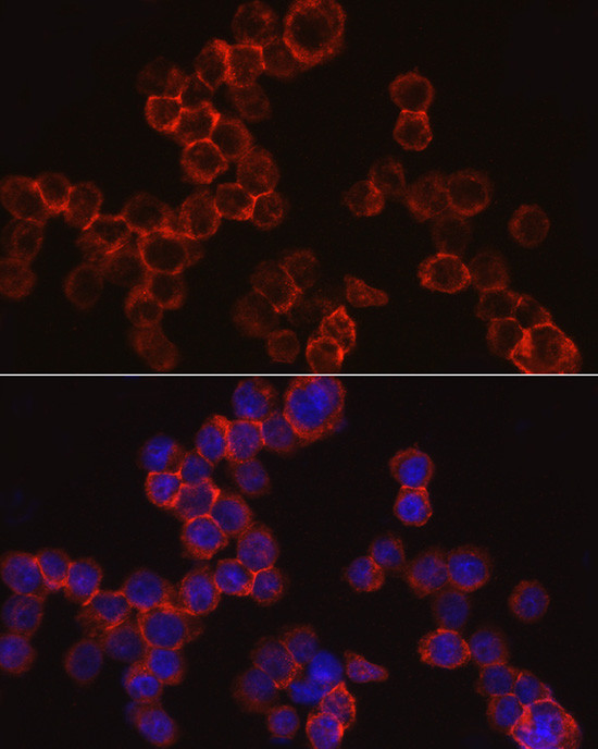 Cathepsin G Antibody in Immunocytochemistry (ICC/IF)