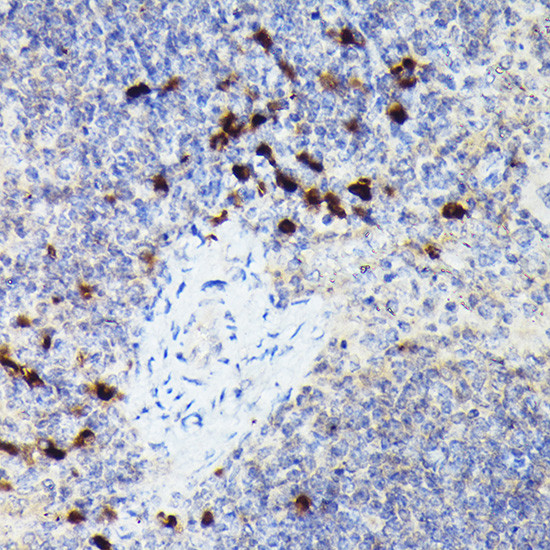 Cathepsin G Antibody in Immunohistochemistry (Paraffin) (IHC (P))