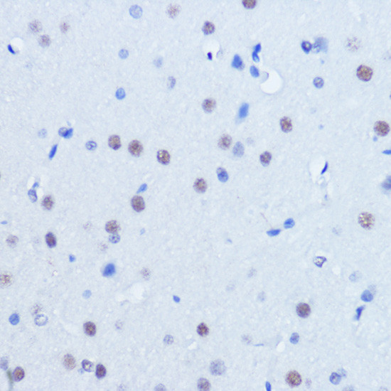 PIAS2 Antibody in Immunohistochemistry (Paraffin) (IHC (P))