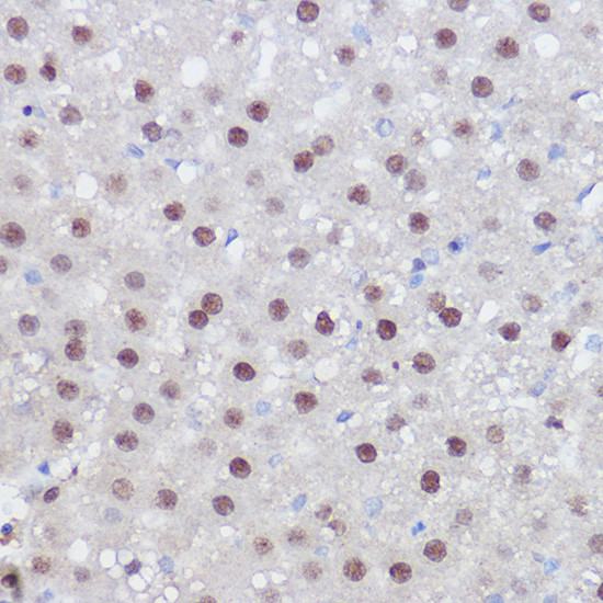 PPAR delta Antibody in Immunohistochemistry (Paraffin) (IHC (P))