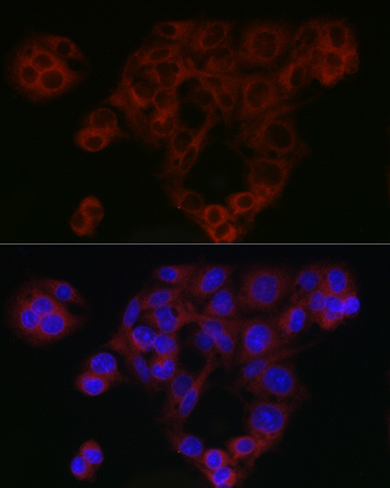 SMAD4 Antibody in Immunocytochemistry (ICC/IF)