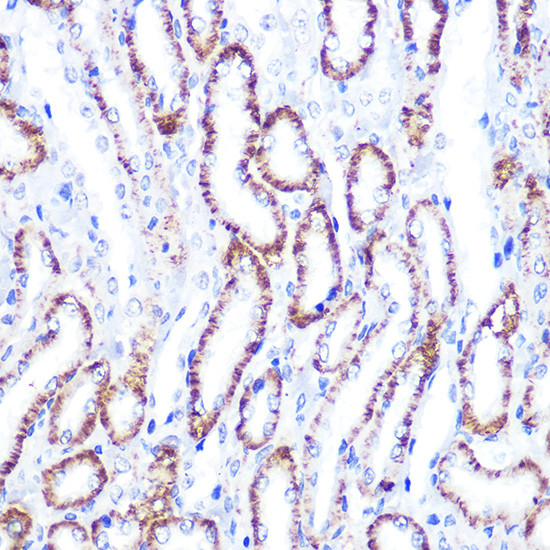 SMAD4 Antibody in Immunohistochemistry (Paraffin) (IHC (P))