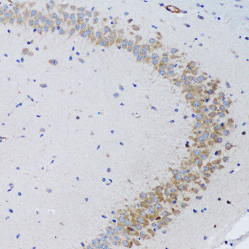 TWEAK Antibody in Immunohistochemistry (Paraffin) (IHC (P))