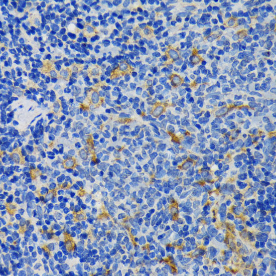 IQGAP1 Antibody in Immunohistochemistry (Paraffin) (IHC (P))