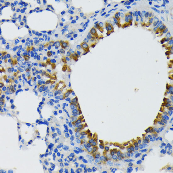 IQGAP1 Antibody in Immunohistochemistry (Paraffin) (IHC (P))