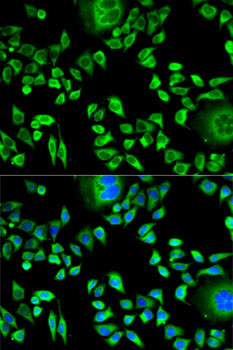 Cystatin A Antibody in Immunocytochemistry (ICC/IF)