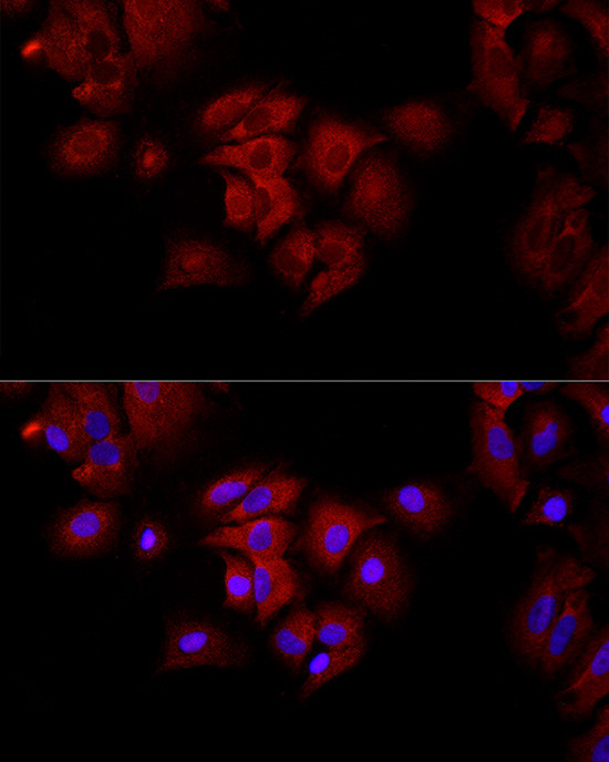 Fumarase Antibody in Immunocytochemistry (ICC/IF)