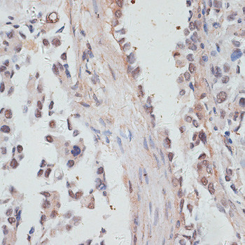 NCOA4 Antibody in Immunohistochemistry (Paraffin) (IHC (P))