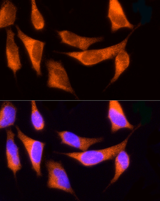 ROCK2 Antibody in Immunocytochemistry (ICC/IF)