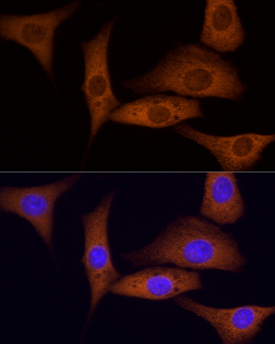 ROCK2 Antibody in Immunocytochemistry (ICC/IF)