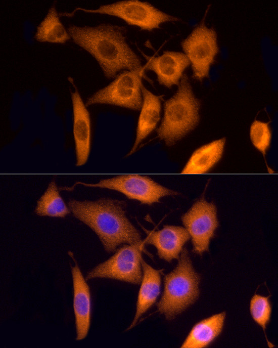 ROCK2 Antibody in Immunocytochemistry (ICC/IF)