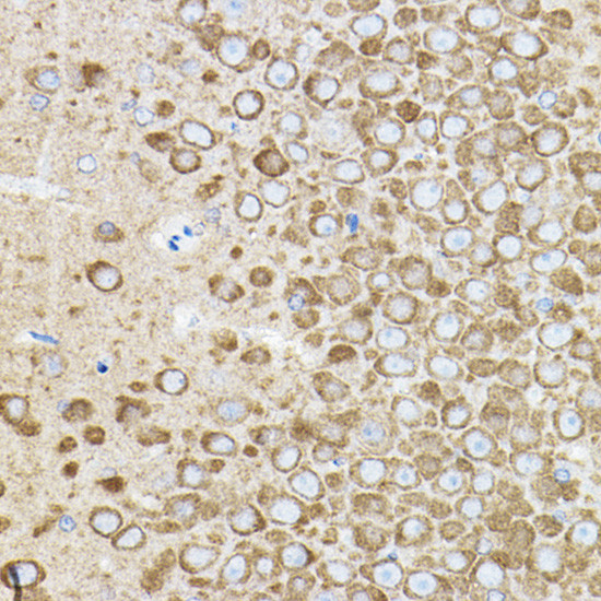 ROCK2 Antibody in Immunohistochemistry (Paraffin) (IHC (P))