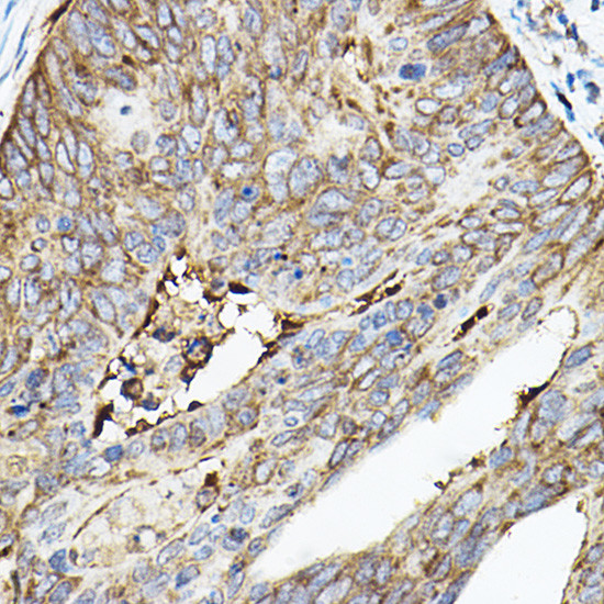 ROCK2 Antibody in Immunohistochemistry (Paraffin) (IHC (P))