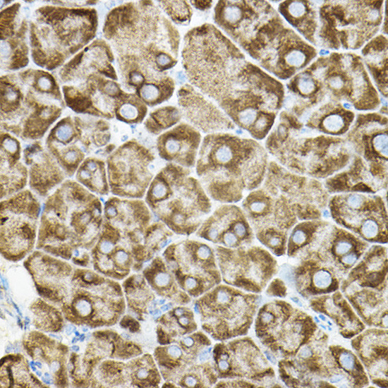 ROCK2 Antibody in Immunohistochemistry (Paraffin) (IHC (P))