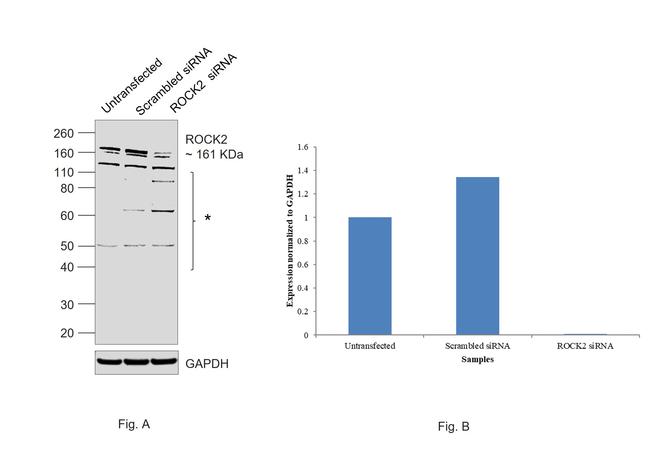 ROCK2 Antibody in Western Blot (WB)