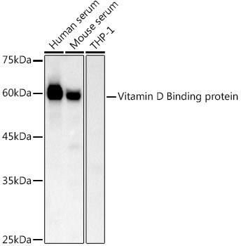 GC Antibody in Western Blot (WB)