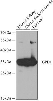 GPD1 Antibody in Western Blot (WB)