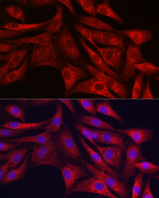 SIRT3 Antibody in Immunocytochemistry (ICC/IF)