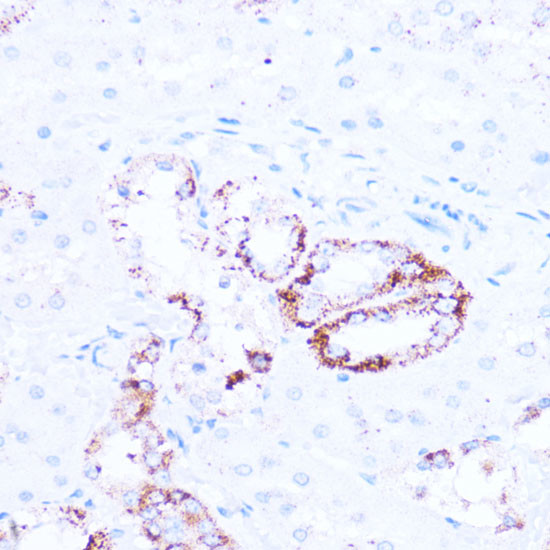 SIRT3 Antibody in Immunohistochemistry (Paraffin) (IHC (P))