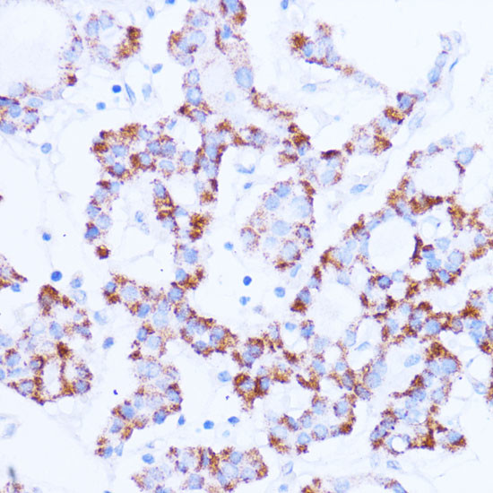 SIRT3 Antibody in Immunohistochemistry (Paraffin) (IHC (P))