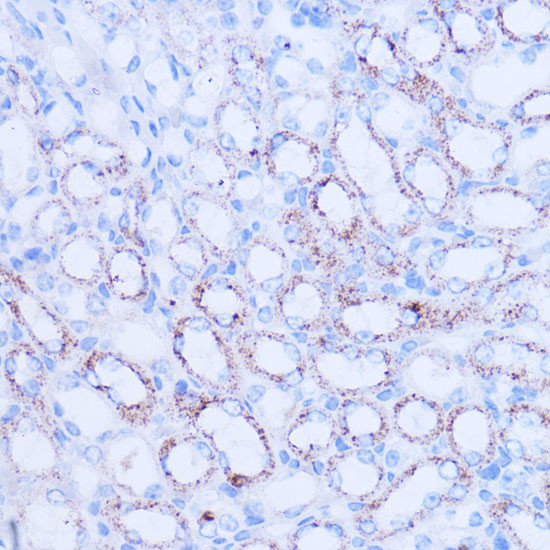 SIRT3 Antibody in Immunohistochemistry (Paraffin) (IHC (P))