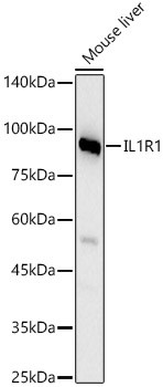 IL1R1 Antibody in Western Blot (WB)