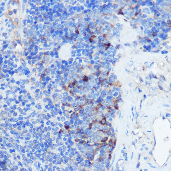 IFNGR1 Antibody in Immunohistochemistry (Paraffin) (IHC (P))