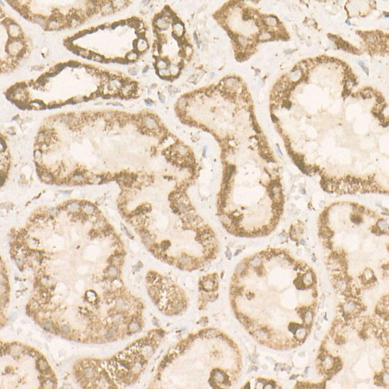 ATP Synthase beta Antibody in Immunohistochemistry (Paraffin) (IHC (P))