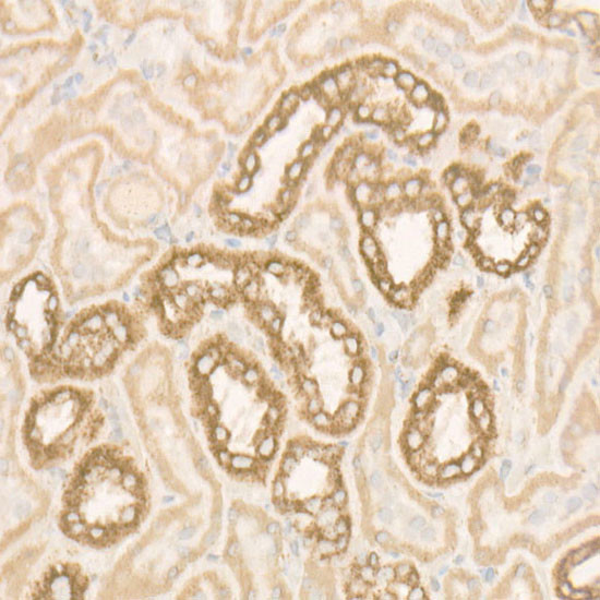 ATP Synthase beta Antibody in Immunohistochemistry (Paraffin) (IHC (P))