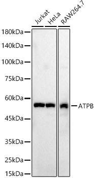 ATP Synthase beta Antibody in Western Blot (WB)