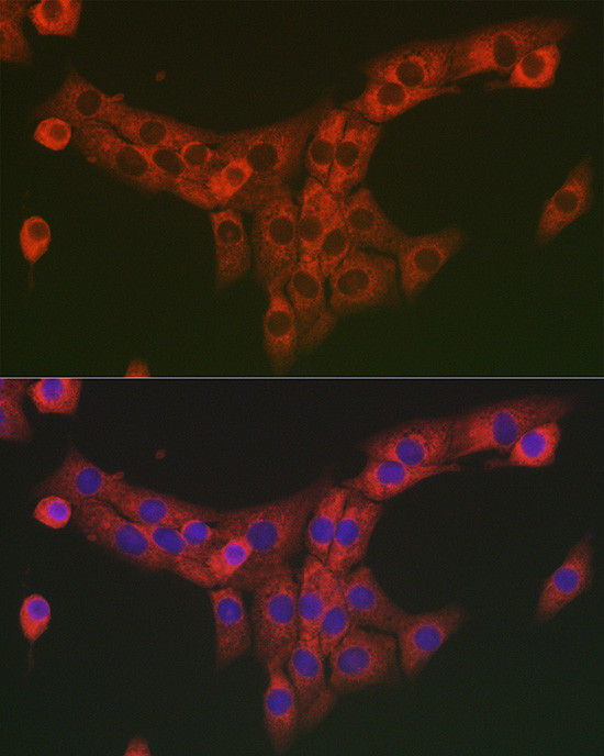 COL1A2 Antibody in Immunocytochemistry (ICC/IF)