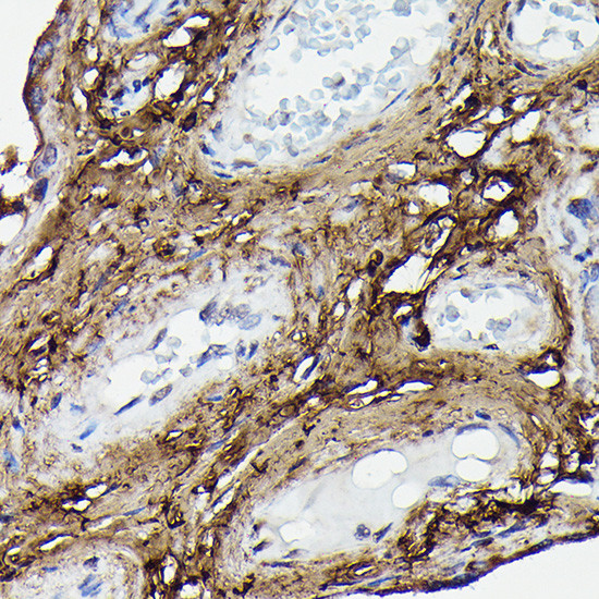 COL1A2 Antibody in Immunohistochemistry (Paraffin) (IHC (P))