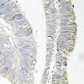 ATP1B1 Antibody in Immunohistochemistry (Paraffin) (IHC (P))