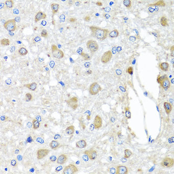 BAG5 Antibody in Immunohistochemistry (Paraffin) (IHC (P))